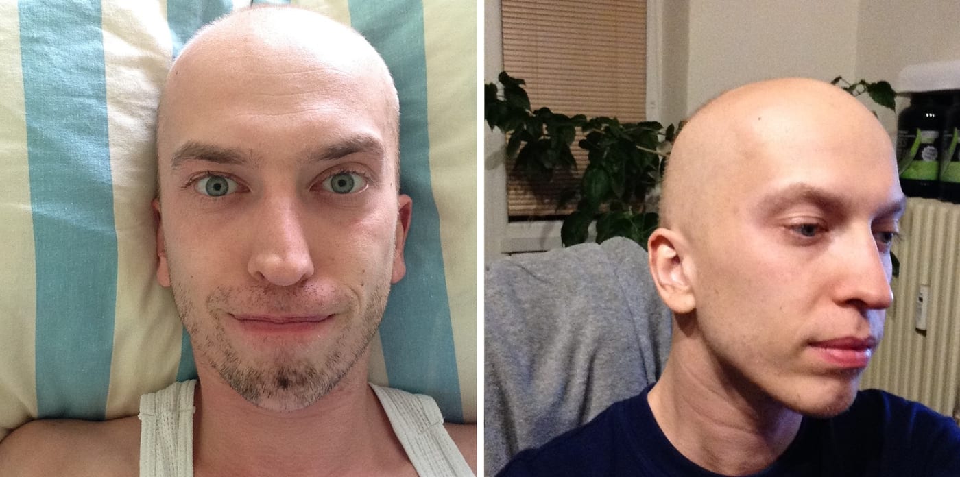 fotografie z liečby