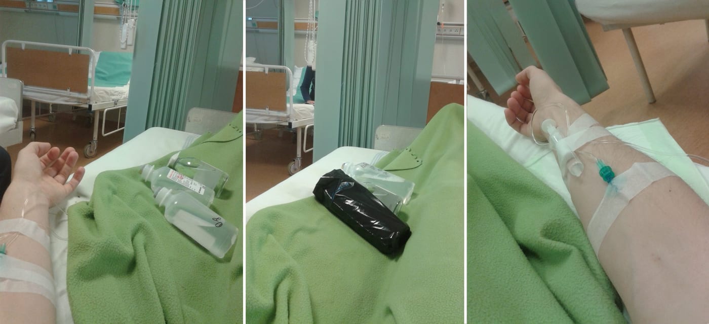 ruky sa počas liečby striedali